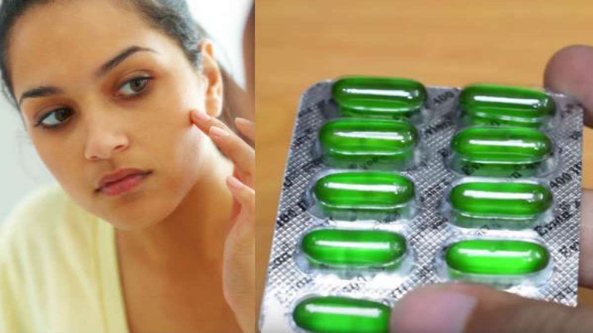 মুখে থাকবে না কোনও দাগছোপ, বাড়বে ত্বকের উজ্জ্বলতা! ব্যবহার করুন ভিটামিন ই How To Apply