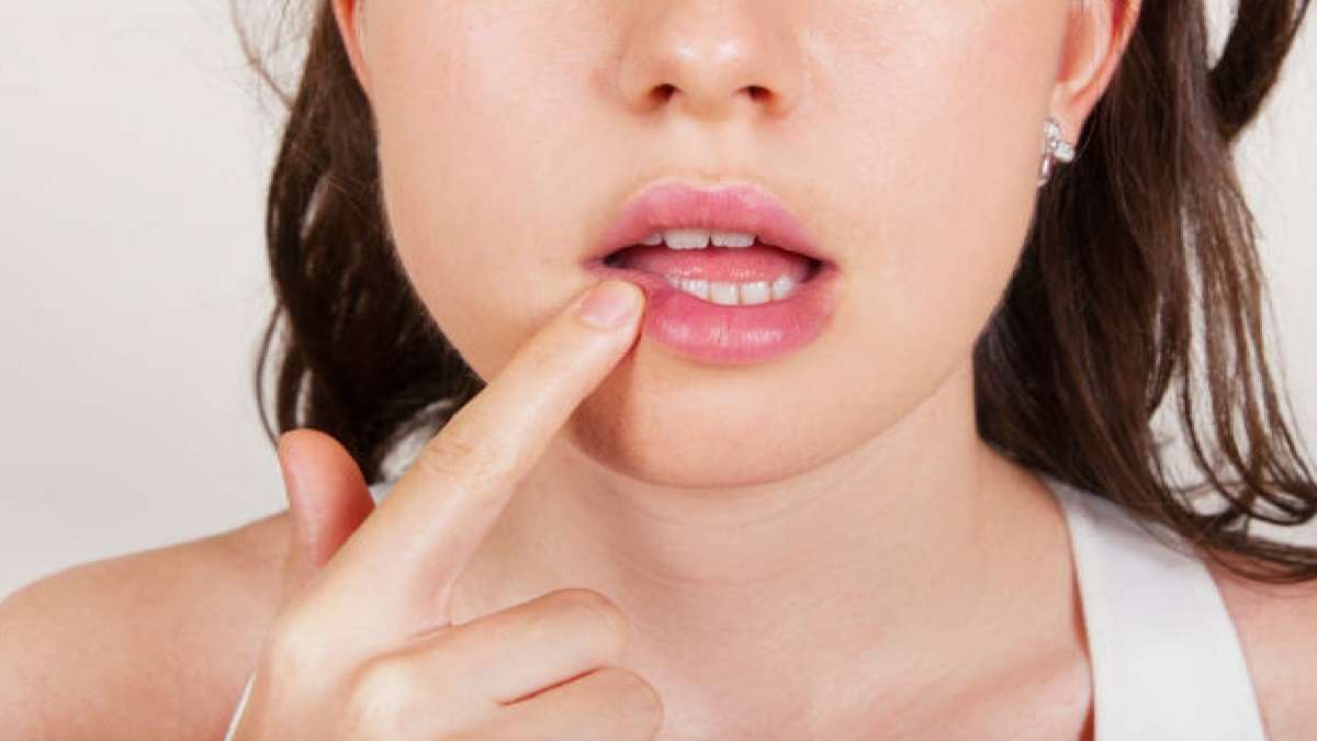 Lip Care in Winter শীতে ঠোঁট ফাটছে? কয়েকটি নিয়ম মেনে চললেই ঠোঁট