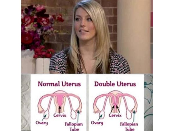 (ছবি) অদ্ভুত অঙ্গধারী এই মানুষদের বাস এই পৃথিবীতেই | Strange Extra Body