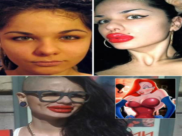 চওড়া ঠোঁট