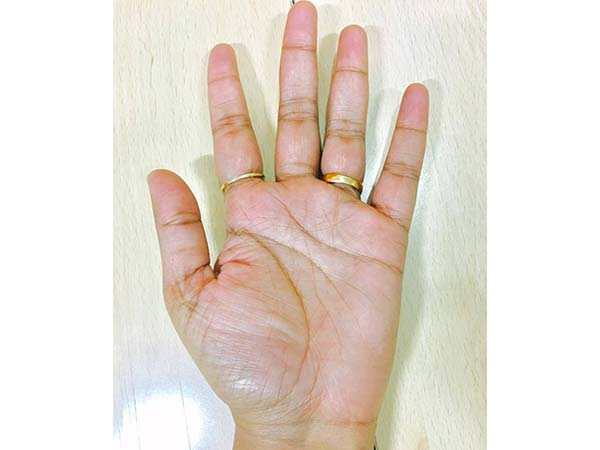 তর্জনী এবং মধ্যমা আঙুলের মধ্যে গ্যাপ