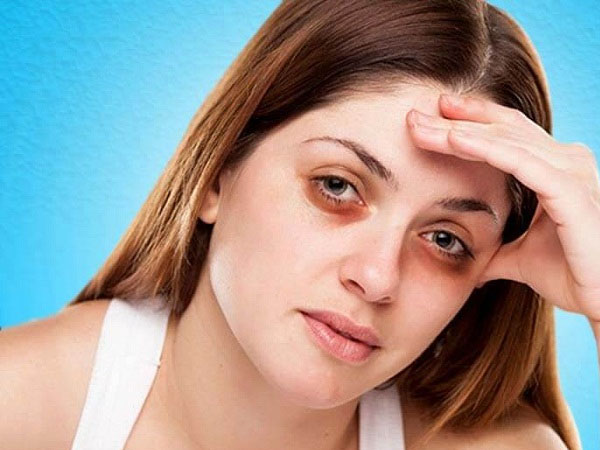 ৩) ডার্ক সার্কেল এবং চোখের ফোলাভাব কমায়